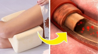 Kẹp một chiếc gối vào giữa hai chân khi ngủ, bạn sẽ bất ngờ với điều này