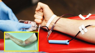 Thiếu nữ bị liệt vĩnh viễn cánh tay phải do sơ suất của y tá trong lúc hiến máu