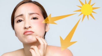 4 lỗi sai trầm trọng khi chăm sóc da mùa đông khiến làn da khô nứt nẻ