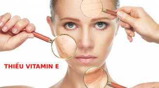 6 dấu hiệu cảnh báo cơ thể thiếu vitamin E, phụ nữ gặp phải tình trạng này sẽ rất nhanh già