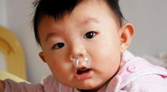 Mách mẹ cách nhìn màu nước mũi phát hiện bệnh của trẻ, gặp dấu hiệu này cần đưa trẻ đi khám gấp