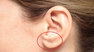 3 bất thường ở tai cho thấy cơ thể đang 'kêu cứu', số 1 cực kỳ nguy hiểm