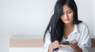 4 thực phẩm lấy sạch canxi trong cơ thể bạn, gây rụng tóc, sạm da: Phụ nữ nên tránh xa