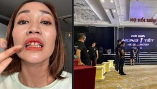 Ốc Thanh Vân khiến fan hoảng hồn khi đăng tải hình ảnh miệng đầy máu do bị thương