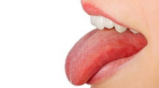 Chuyên gia Đông y cho biết lưỡi có 3 dấu hiệu này cơ thể đang suy kiệt, chớ dại coi thường