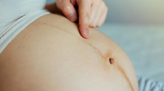 Khi mang thai, 5 vị trí trên cơ thể chuyển sang màu đen: Số 1 càng tối màu thai nhi càng khỏe