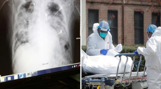 Vừa cảm tạ vì được ghép phổi, người phụ nữ qua đời sau 3 ngày: Phổi người hiến nhiễm virus nCoV
