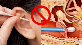 4 thói quen làm hại tai của bạn, ảnh hưởng não bộ nhưng nhiều người Việt vẫn phạm phải