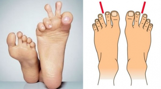 Nhìn bàn chân biết ngay hậu vận, 4 kiểu cho thấy chủ nhân giàu sang, cả đời an nhàn, hưởng phúc