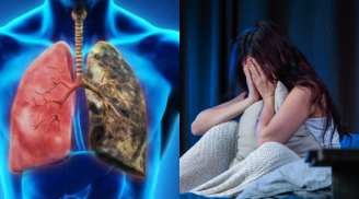 3 dấu hiệu vào ban đêm cảnh báo phổi tổn thương nặng, không khám chữa ngay chẳng mấy sẽ đến giai đoạn cuối