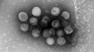 Xuất hiện 2 loại virus mới cùng họ với Covid-19, lây từ động vật sang người