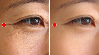 Các bài tập massage da của người Nhật giúp chị em xóa tan nếp nhăn, quầng thâm quanh mắt