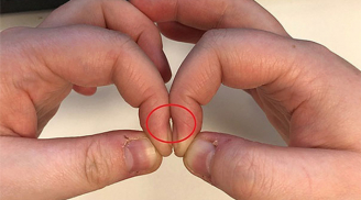 Đặt 2 đầu ngón tay trỏ sát nhau, đoán ngay hai lá phổi của bạn khỏe mạnh hay suy yếu