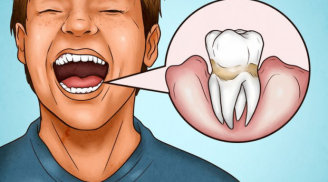 4 dấu hiệu cho thấy bạn đang đánh răng sai cách, làm hỏng răng lợi