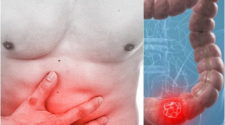 6 dấu hiệu cảnh báo bệnh đường ruột của bạn đang bệnh nặng, chỉ cần có 1 cũng nên đi khám