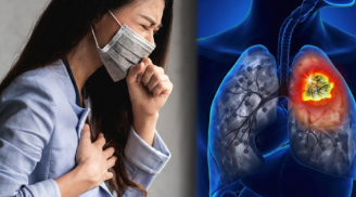 5 dấu hiệu cho thấy phổi bị hư, ngầm cảnh báo bệnh nan y đang phát triển