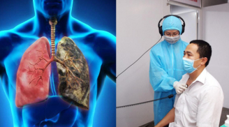 Ngoài thuốc lá còn 5 thói quen hại phổi, làm hỏng hệ hô hấp, nhiều người vẫn làm hàng ngày