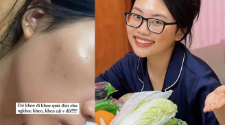 Tốn công chăm sóc nhưng Phương Mỹ Chi vẫn đau đầu vì da đầy khuyết điểm