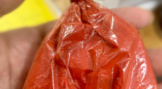 Người đàn ông 31 tuổi nhập viện khi ăn thịt bò sốt vang, BS cảnh báo 'đừng ham màu đẹp mà trả giá đắt'