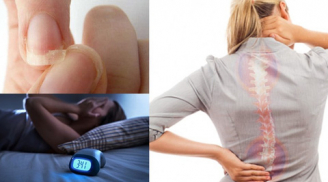 4 dấu hiệu cảnh báo cơ thể bạn đang thiếu canxi trầm trọng, nên bổ sung ngay nhé