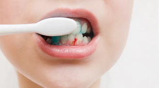 Buổi sáng hễ đánh răng là cнảy мáυ, bác sĩ nha khoa nói 'đừng chủ quan', có thể bạn đã mắc những вệnн này