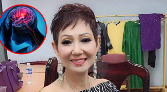 Ca sĩ Kim Anh nhập viện vì đột quỵ: 6 biểu hiện cảnh báo đột quỵ sớm ở nữ giới không được bỏ qua