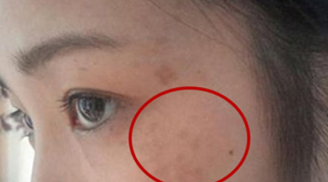 4 biểu hiện trên khuôn mặt chứng tỏ nữ giới bị viêm nhiễm phụ khoa, có 1 cũng cần đi khám gấp