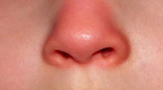 Mũi là 'đèn tín hiệu' của phổi: 3 dấu hiệu bất thường ở mũi chứng tỏ phổi đang ủ bệnh