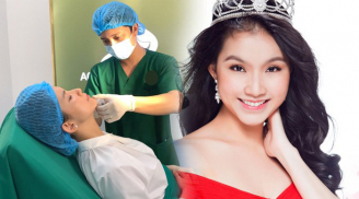 Hoa hậu Thùy Lâm lần đầu tiên can thiệp thẩm mỹ sau 13 năm đăng quang
