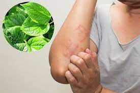 9 loại lá tắm hết dị ứng, nổi mề đay ngứa ngáy khi trời lạnh: Dùng thường xuyên sẽ đỡ