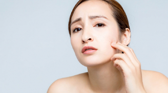 Bật mí một vài tips chăm sóc da đúng cách khi bị mụn trứng cá