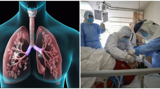 2 di chứng nặng nề nhất ở phổi mà F0 có thể gặp: Phổi trắng tinh nếu phát hiện muộn