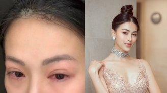 Hoa hậu Phương Khánh gặp vấn đề nghiêm trọng ở mắt, phải huỷ bỏ mọi lịch trình