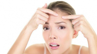 4 cách chăm sóc da sau khi nặn mụn chị em cần ghi nhớ để không làm da bị tổn thương