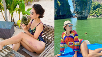 Thu Minh kể chuyện da bị bầm tím nhưng body đẹp không tì vết mới là tâm điểm chú ý