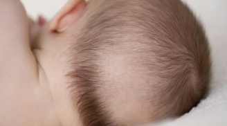 Trẻ nhỏ bị rụng tóc cha mẹ cần xử lý thế nào?