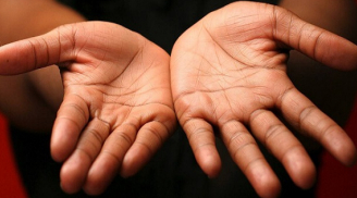 Bàn tay có 1 trong 5 đặc điểm này, cuộc đời vất vả, làm mãi vẫn nghèo