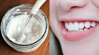 Trộn kem đánh răng với thứ này: Sạch cao răng, hết viêm lợi, hôi miệng