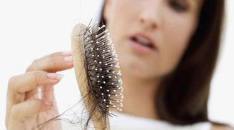 6 nguyên nhân phổ biến nhất gây rụng tóc và loạt cách giải quyết chị em nào cũng nên ghim lại