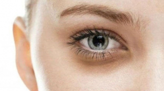 6 loại thực phẩm giúp chị em cải thiện quầng thâm mắt ngay từ bên trong
