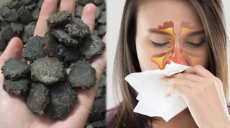 8 cách trị viêm xoang tại nhà đơn giản mà hiệu quả