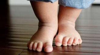3 tật về phát triển vận động thường thấy ở trẻ, cha mẹ cần nắm rõ để phát hiện sớm