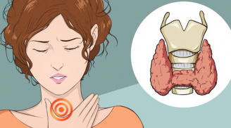  6 dấu hiệu cảnh báo sớm bệnh tuyến giáp nhưng nữ giới hay bỏ qua