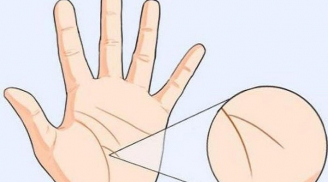 Bàn tay có 1 trong 4 dấu hiệu này chủ nhân đen đủ đường cẩn thận đau ốm tai ương, mất cả cơ ngơi?