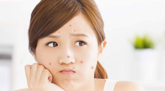 5 sản phẩm làm đẹp bạn nên cẩn trọng khi sử dụng trong những ngày cận Tết