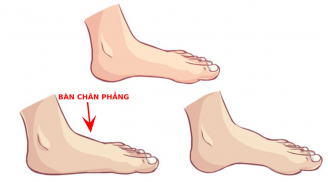 Vì sao cổ nhân dạy: 'Chân như cái đĩa phẳng, nghèo khó chẳng dứt'?