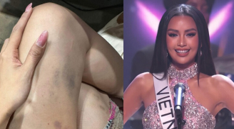 Ngọc Châu gây xót xa với đôi chân bầm dập, đôi mắt đỏ hoe khi trượt top 16 tại Miss Universe 2022