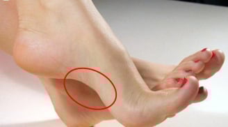 Phụ nữ có 5 đặc điểm này ở bàn chân, càng về già càng may mắn, tha hồ hưởng lộc