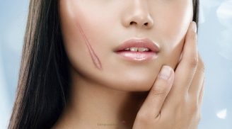 Bật mí cách xử lý da mặt bị trầy xước không lo để lại sẹo