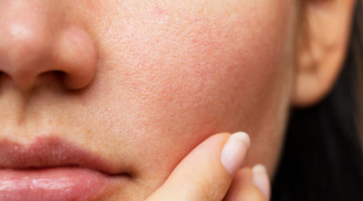 Chuyên gia bật mí loạt tips tránh bít tắc lỗ chân lông vùng mũi để da luôn sạch và thông thoáng
